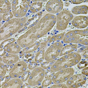 ANXA8L1 Antibody