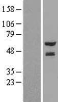 NMT2 Protein (Over-Expression Lysate Myc-DDK (Flag))