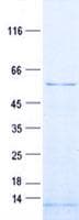 Human BMP3 Protein (Recombinant His, N-Terminal)