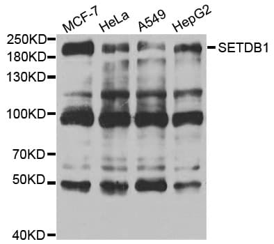 Polyclonal Rabbit anti-Human ESET / SETDB1 Antibody (IHC, WB)