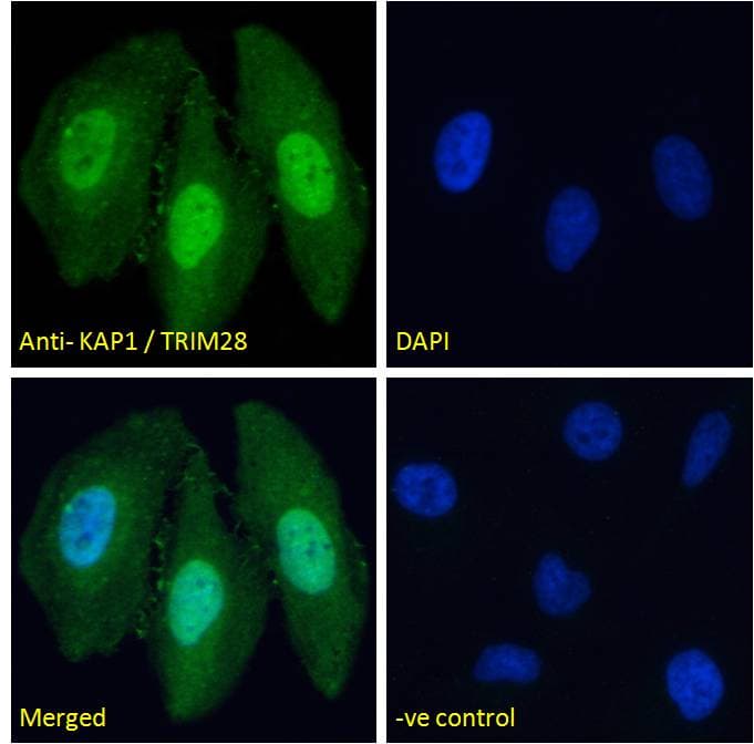 IHC-plus™ Polyclonal Goat anti-Human TRIM28 / KAP1 Antibody (aa823-835, IHC, IF)