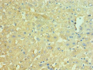 Polyclonal Rabbit anti-Human NAMPT / Visfatin Antibody (aa1-280, IHC)