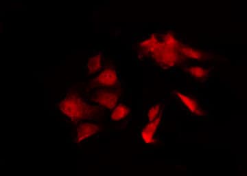 DGKQ Antibody