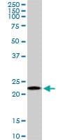 Monoclonal Mouse anti-Human RPS5 / Ribosomal Protein S5 Antibody (clone 3G3, WB)