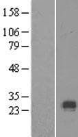 COL10A1 / Collagen X Protein (Over-Expression Lysate Myc-DDK (Flag))