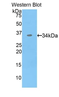 Polyclonal Rabbit anti-Mouse CDK4 Antibody (aa6-295, WB)