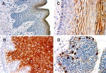 NALP1 / NLRP1 Antibody (aa161-180)