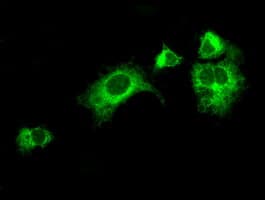 LOX / Lysyl Oxidase Antibody (clone OTI3C3)