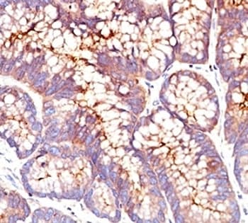 CEA / Carcinoembryonic Antigen Antibody (clone SPM541)