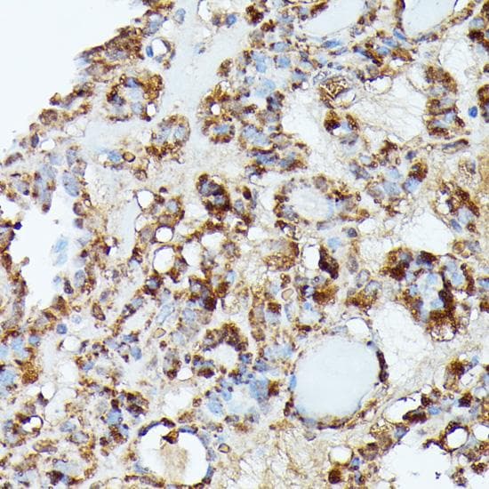 Polyclonal Rabbit anti-Human NBP / NUBP1 Antibody (IHC)
