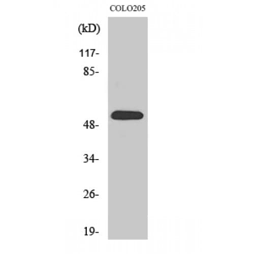 HARS Antibody (430-510 aa, C-terminal)