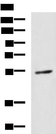 Polyclonal Rabbit anti-Human GBA / Glucosidase Beta Acid Antibody (IHC, WB)