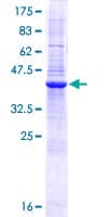 Human MRAP Protein (Recombinant GST)
