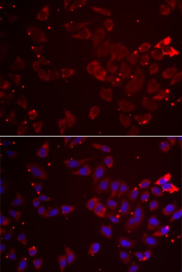 GATM / AGAT Antibody
