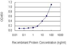LGALS1 / Galectin 1 Antibody (clone 1E8-1B2)