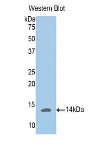 PGM5 / Aciculin Antibody (aa182-296, PE)