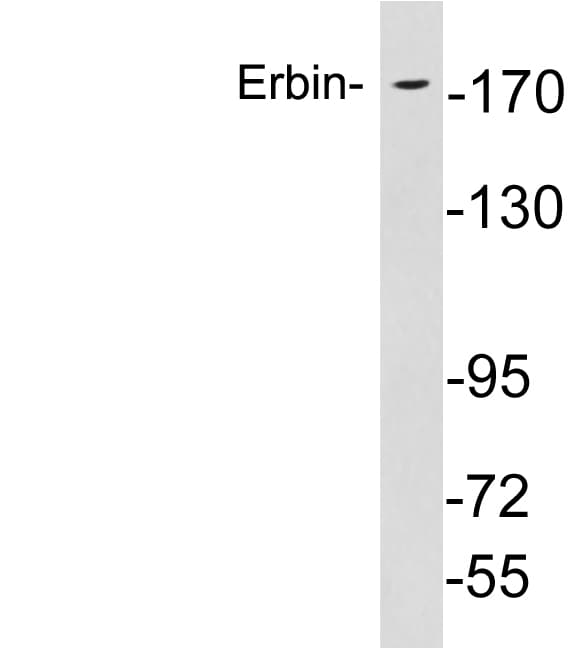 Polyclonal Rabbit anti-Human ERBB2IP / Erbin Antibody (aa1061-1110, WB)