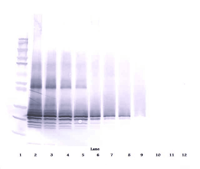OSM / Oncostatin M Antibody