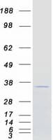 Human N4BP2L1 Protein (Recombinant Myc-DDK (Flag))