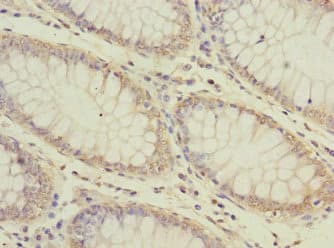 Polyclonal Rabbit anti-Human ATP6V0D1 Antibody (IHC)