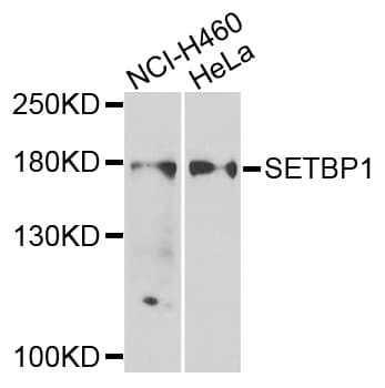 SETBP1 / SEB Antibody