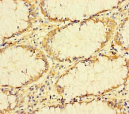 Polyclonal Rabbit anti-Human TUBA1B / Tubulin Alpha 1B Antibody (IHC, IF, WB)