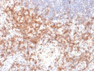 Recombinant Monoclonal Rabbit anti-Human CD27 Antibody (clone LPFS2/2034R, IHC)
