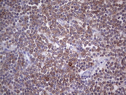 Monoclonal Mouse anti-Human PKM2 Antibody (clone 11B11, IHC, WB)
