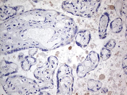 TACC2 Antibody (aa727-1026, clone OTI1C3, Carrier-free)