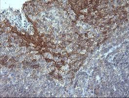 ERBB2 / HER2 Antibody (aa676-1255, clone OTI5F6, Carrier-free)