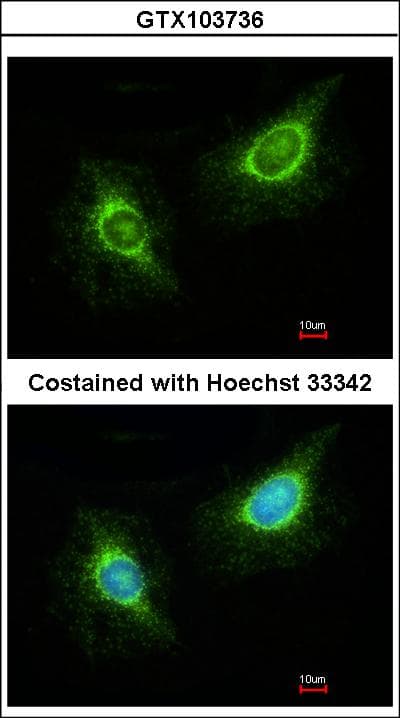 IHC-plus™ LAMB3 / Laminin Beta 3 Antibody (aa644-960)