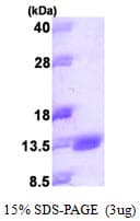 Human BCMP84 / S100A14 Protein (Recombinant His)