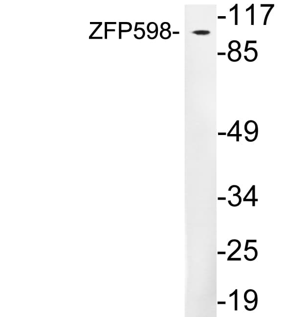 Polyclonal Rabbit anti-Human ZNF598 Antibody (aa254-303, WB)