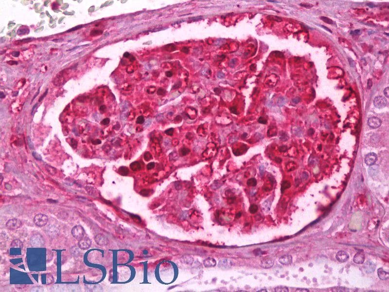 IHC-plus™ LGALS1 / Galectin 1 Antibody (clone 24CT661.4.3)