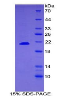 Human Dermatopontin / DPT Protein (Recombinant His)