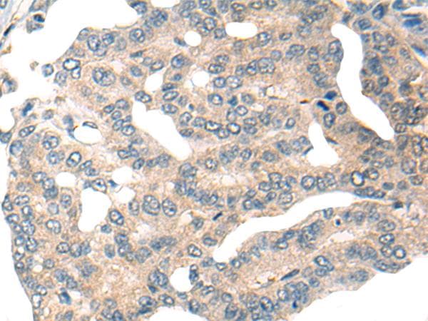 HIPK2 Antibody