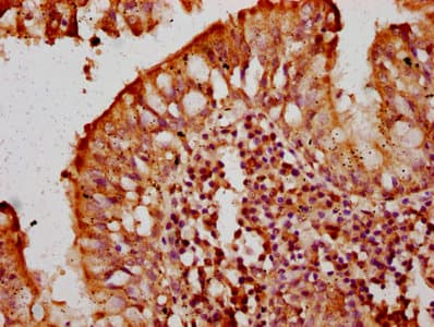 TIRC7 / TCIRG1 Antibody