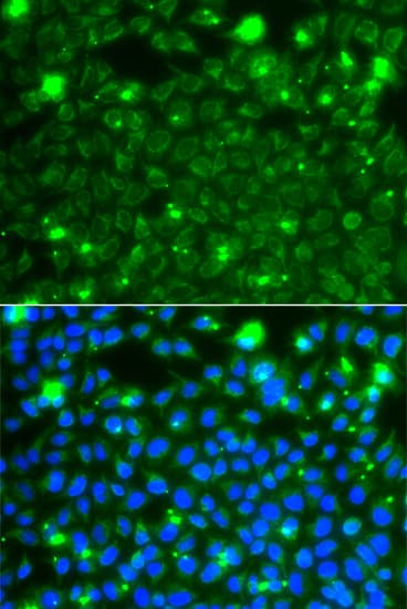Polyclonal Rabbit anti-Human HSPE1 / HSP10 / Chaperonin 10 Antibody (IHC, IF, WB)