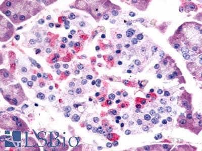 PathPlus™ Polyclonal Rabbit anti-Human SSTR1 Antibody (C-Terminus, IHC)