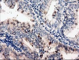 Latexin / MUM Antibody (clone OTI2G4, Carrier-free)
