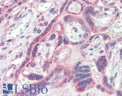 IHC-plus™ PD-L2 / PDCD1LG2 / CD273 Antibody (clone 4E10)