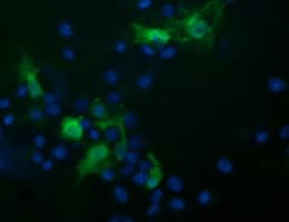 TRIM44 Antibody (clone OTI6F10)