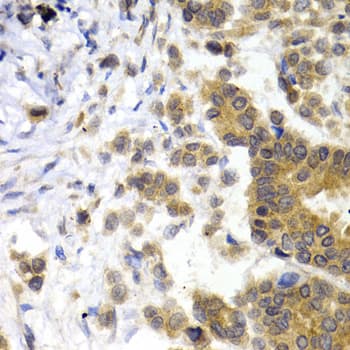 NF-L / NEFL Antibody