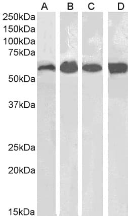 IHC-plus™ CAT / Catalase Antibody (aa498-511)