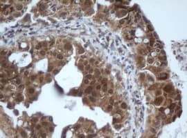 PRR11 Antibody (aa125-360, clone OTI2A10, Carrier-free)