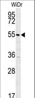 TSPYL4 Antibody (aa6-32)