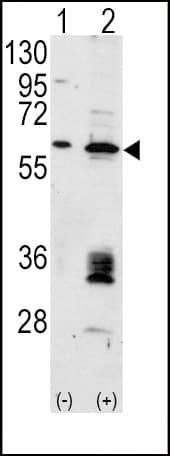 MDM2 Antibody (aa393-424)