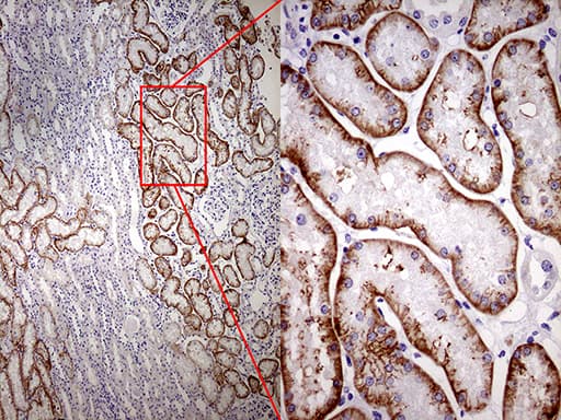 Monoclonal Mouse anti-Human ROR2 Antibody (clone OTI3F8, aa796-927, IHC, WB)