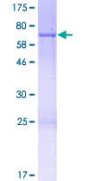 Human NSUN5 Protein (Recombinant GST)