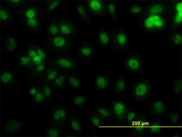 IHC-plus™ PCNA Antibody (clone 1G7)